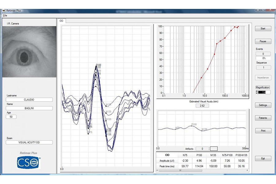 RETIMAX SWEEP VEP AND SEQUENCES